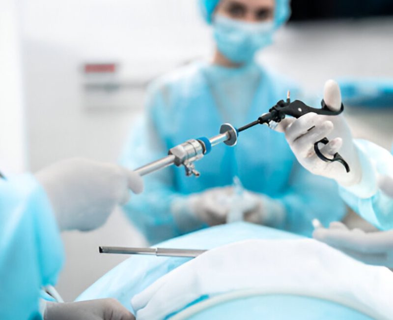 Laparoscopic 2